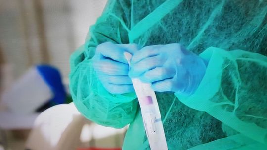 Pięć osób w powiecie gryfińskim z potwierdzonym zakażeniem wirusem SARS-CoV-2