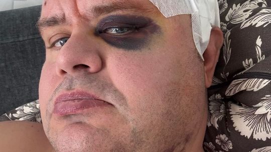 Wojciech Szumotalski walczy z glejakiem IV stopnia. „Chcę patrzeć, jak dorastają moi synowie”